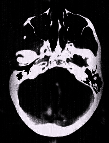 head.thumb.png.445d91bf33a23ec900aa9cd1c