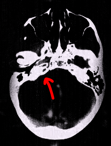 headarrow.thumb.png.52fb2ae53392cb934eb4